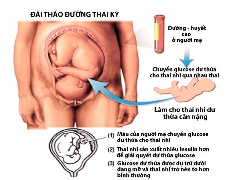 THAI TO CÓ NGUY HIỂM KHÔNG? NHỮNG ĐIỀU MẸ BẦU CẦN BIẾT